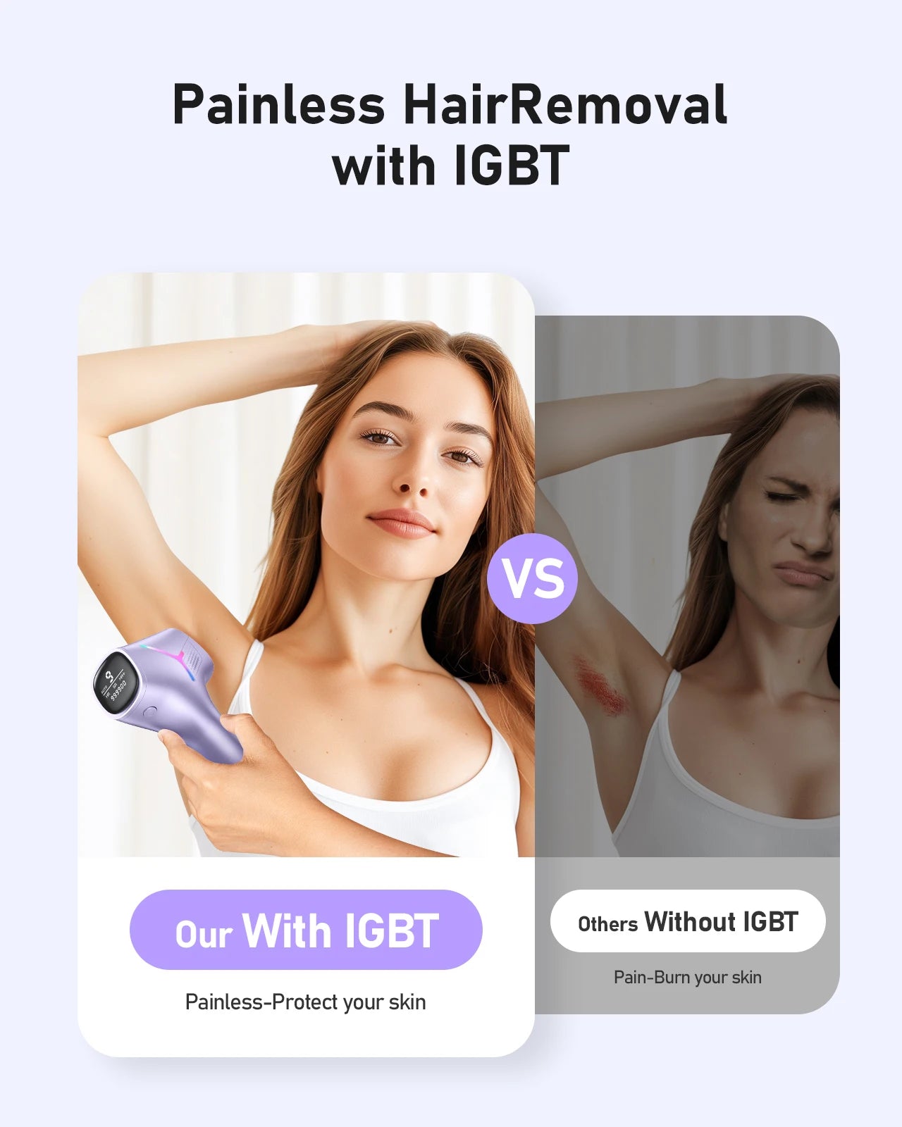 IPL Laser Hair Removal Device – 9 Energy Levels Permanent Hair Remover